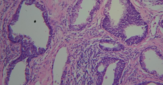 Healthy Prostatic Fluid Is Essential For Male Fertility